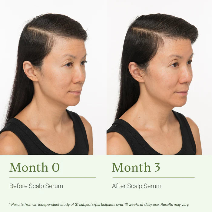 VitaRoot-  Scalp & Hair Strand Therapy