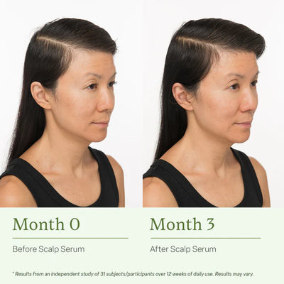 VitaRoot-  Scalp & Hair Strand Therapy